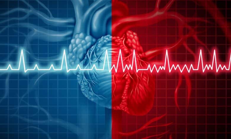Irregular heartbeat