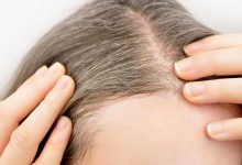 علل و درمان سفید یا خاکستری شدن موی کودک