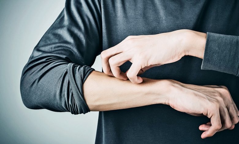 خارش بدن بعد از نزديكی