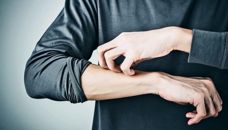 خارش بدن بعد از نزديكی
