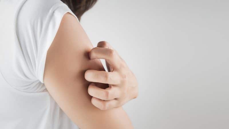 upper arm itch