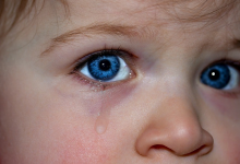 کبودی زیر چشم کودک