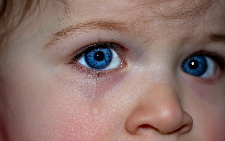 کبودی زیر چشم کودک
