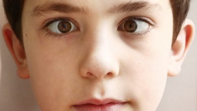 دوبینی چشم در کودکان
