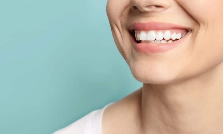 اصلاح طرح لبخند