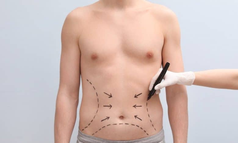 افراد مناسب جراحی پیکرتراشی چه کسانی هستند؟