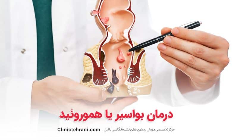 درمان بواسیر یا هموروئید