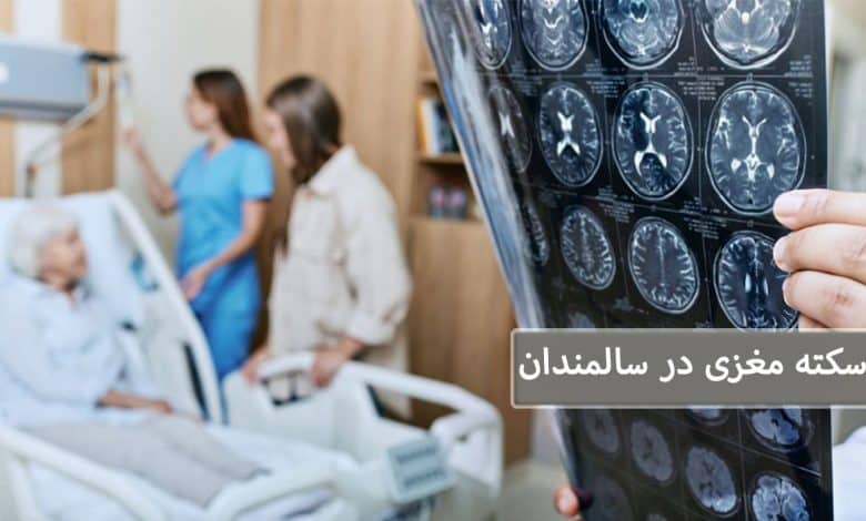 سکته مغزی در سالمندان