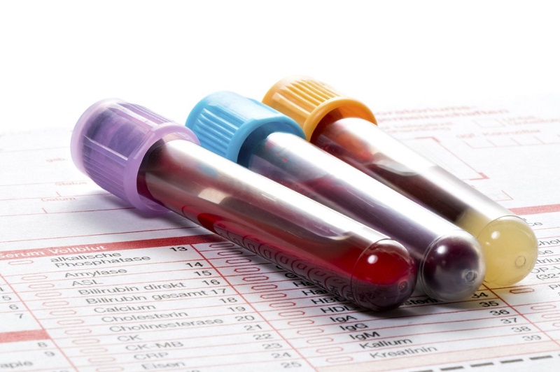 آزمایش خون در منزل یا محل کار