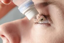 استفاده از اشک مصنوعی جهت درمان خشکی چشم بعد از لیزیک