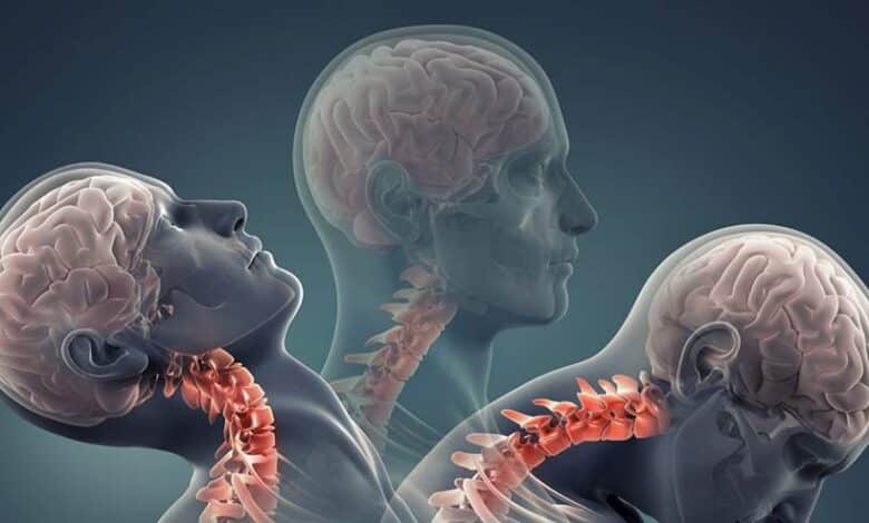 علائم ضربه مغزی تا چند ساعت مشخص می شود؟!