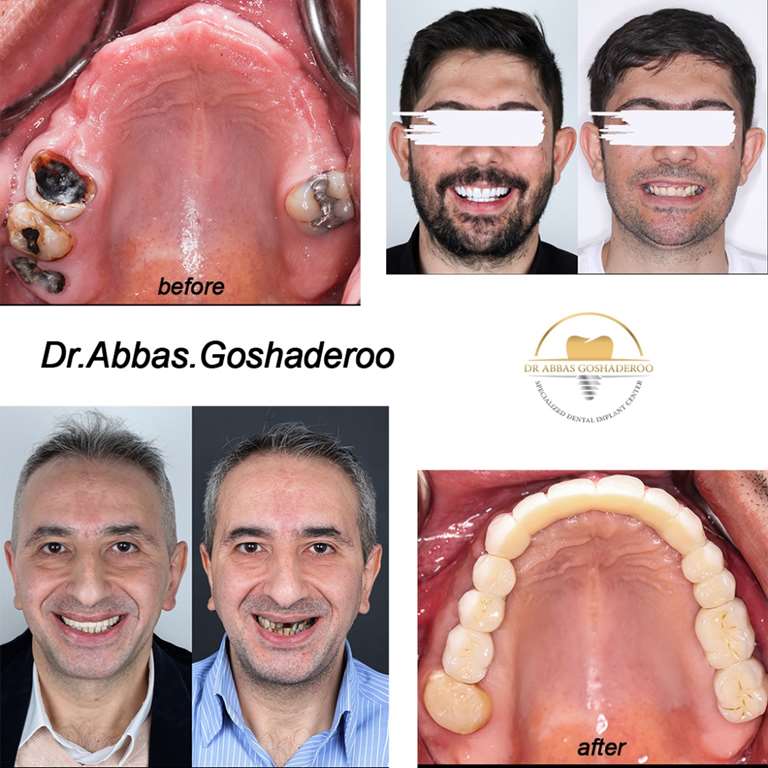 دکتر گشاده رو پیشتاز در دندانپزشکی دیجیتال!