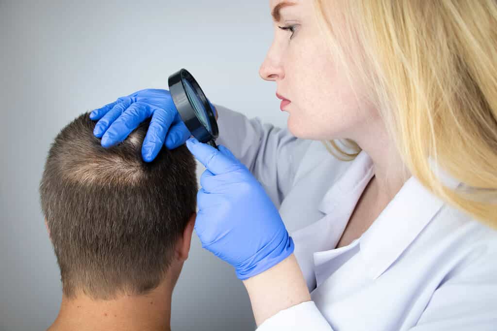 A trichologist examines the hair of a man who begins alopecia. Consultation with a dermatologist. Hair loss, alopecia, pruritus, burning head or seborrhea - Photo, Image