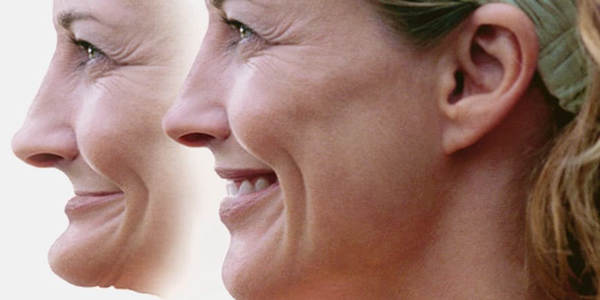 Reasons for Jawbone Loss and Deterioration - DENTAL VIP Posts - تصویر 3 Reasons for Jawbone Loss and Deterioration - DENTAL VIP Posts