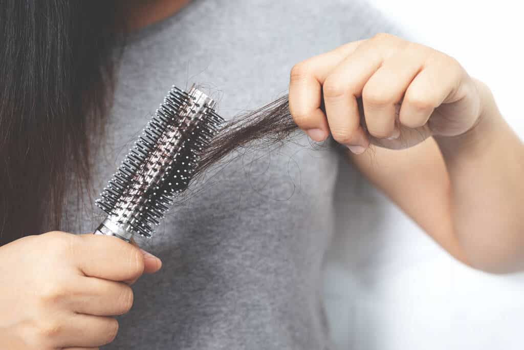 Women with hair loss Because she is allergic to shampoo - Photo, Image