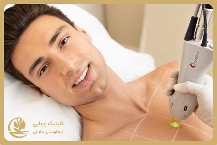 هزینه خدمات لیزر در کلینیک عرفان نیایش