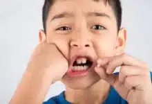 ایمپلنت دندان برای کودکان