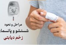 مراحل و نحوه شستشو و پانسمان زخم دیابتی
