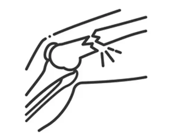 نقاشی پوکی استخوان 3