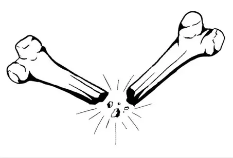 نقاشی پوکی استخوان 8