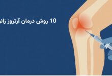 10 روش درمان آرتروز زانو + روش های پیشگیری