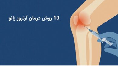 10 روش درمان آرتروز زانو + روش های پیشگیری