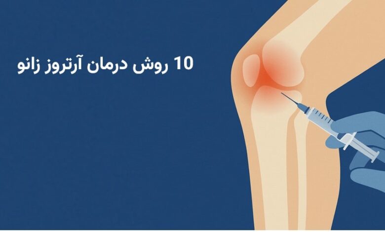 10 روش درمان آرتروز زانو + روش های پیشگیری