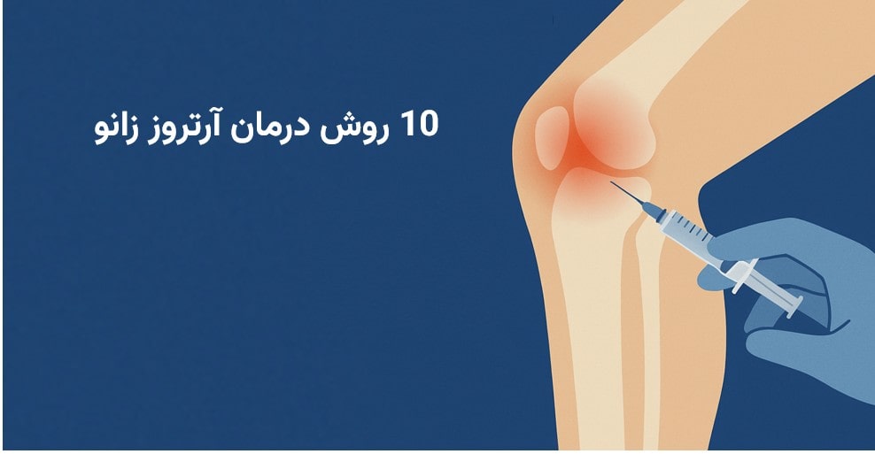 10 روش درمان آرتروز زانو + روش های پیشگیری