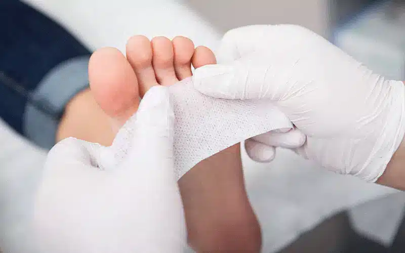 بهبود زخم های دیابت
