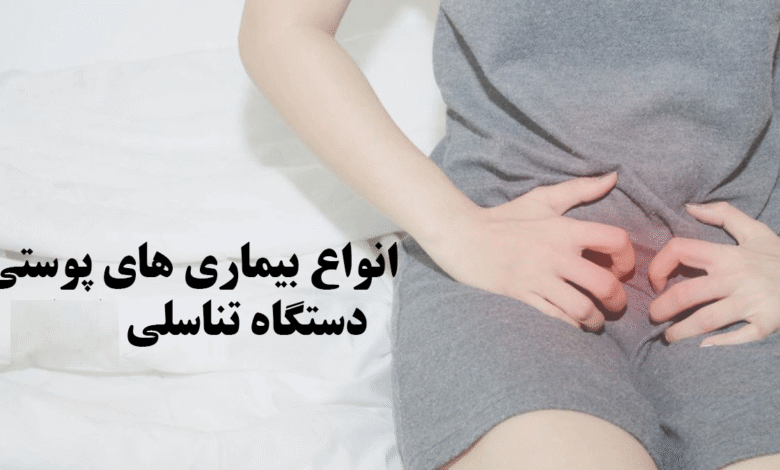 بیماری های پوستی در نواحی تناسلی
