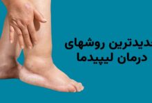 جدیدترین روش های درمان لیپیدما