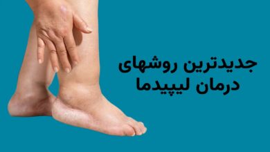 جدیدترین روش های درمان لیپیدما