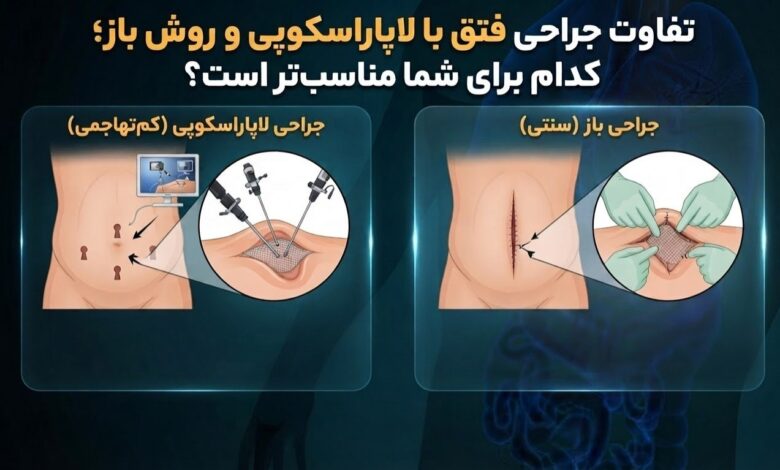 تفاوت جراحی فتق با لاپاراسکوپی و روش باز