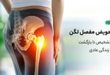 تعویض مفصل لگن: از تشخیص تا بازگشت به زندگی عادی