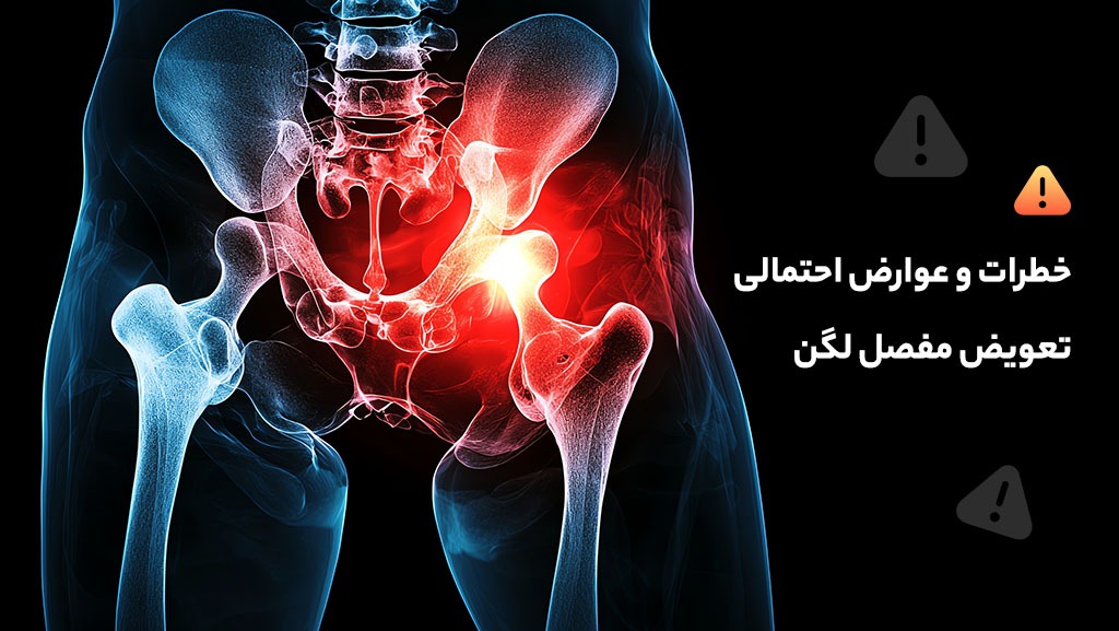خطرات و عوارض احتمالی تعویض مفصل لگن
