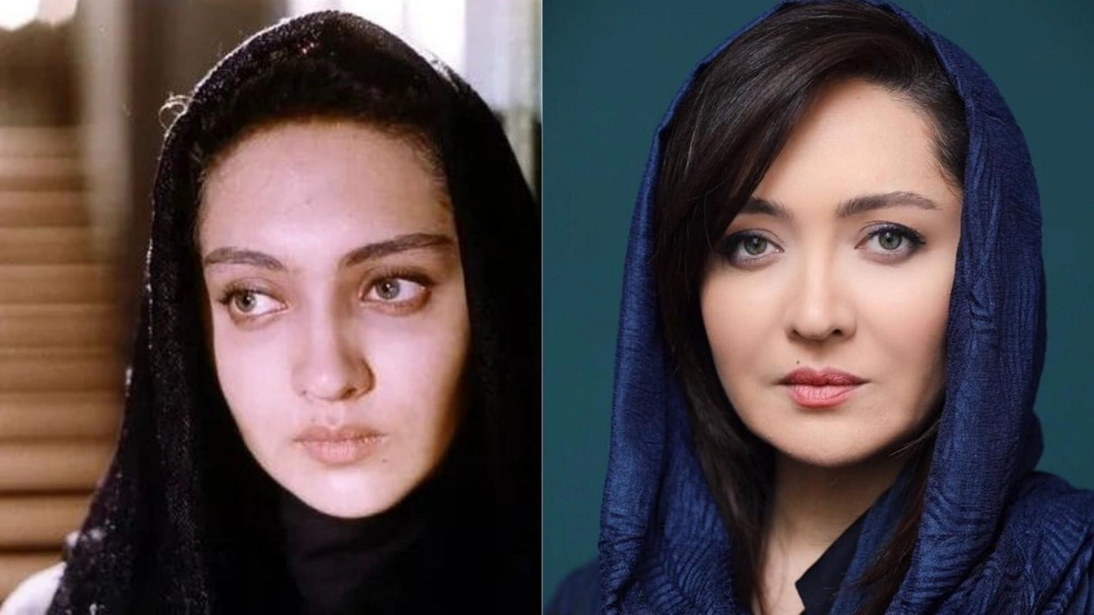 قبل و بعد افراد مشهور ایرانی 1 قبل و بعد افراد مشهور ایرانی 1