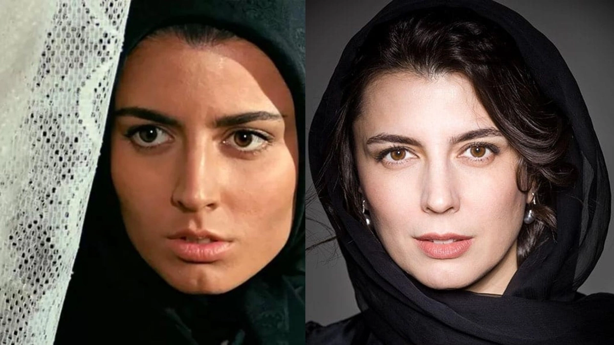 قبل و بعد افراد مشهور ایرانی 2 قبل و بعد افراد مشهور ایرانی 2