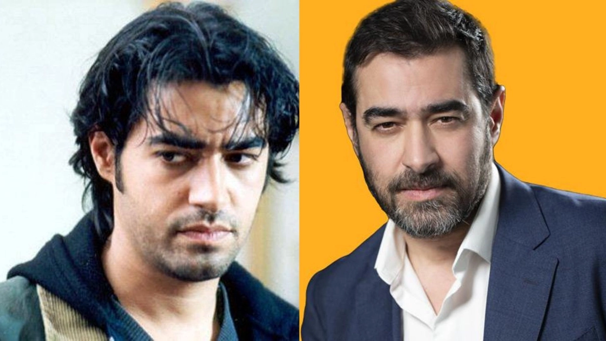 قبل و بعد افراد مشهور ایرانی 3 قبل و بعد افراد مشهور ایرانی 3