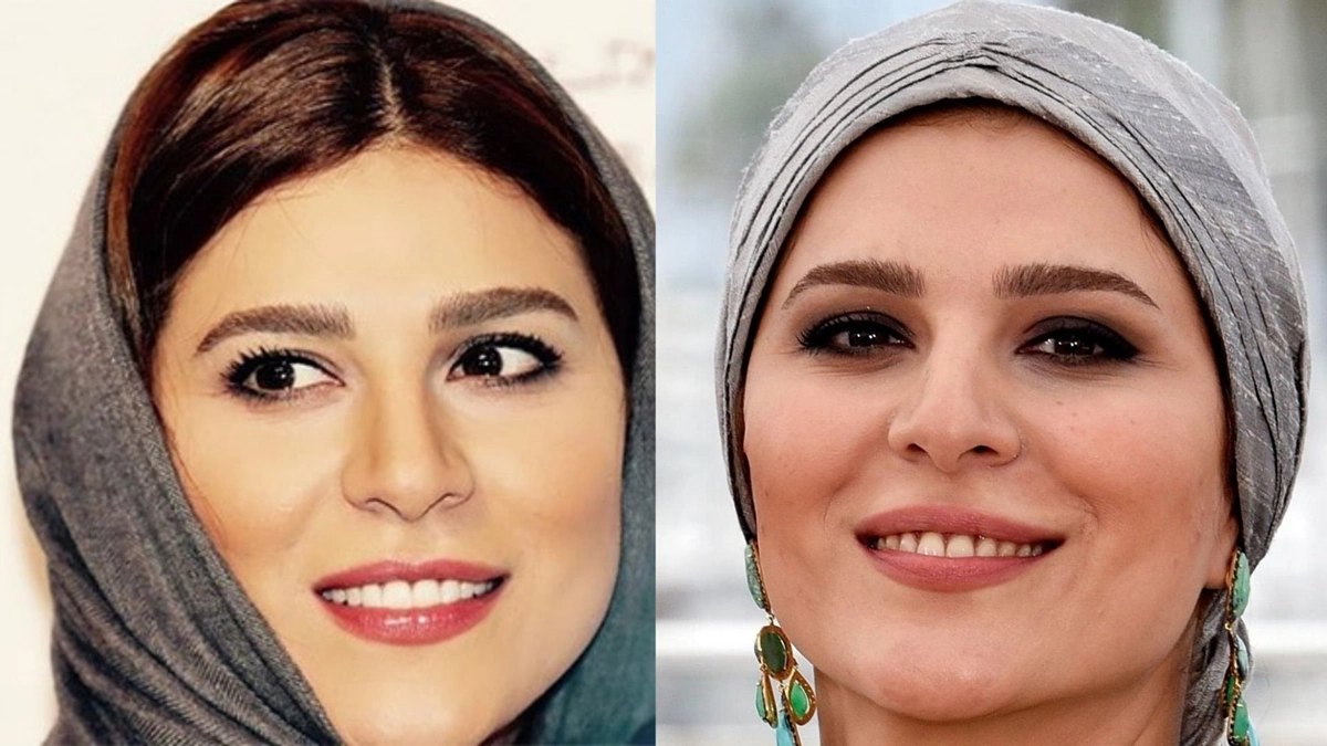 قبل و بعد افراد مشهور ایرانی 4 قبل و بعد افراد مشهور ایرانی 4