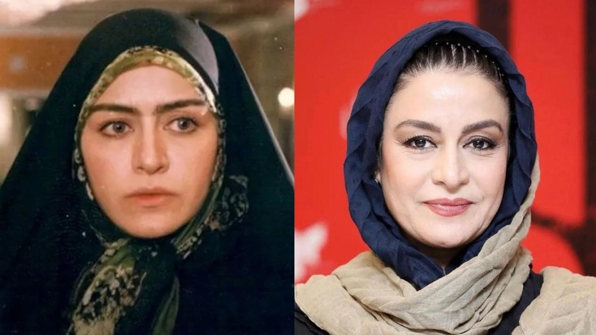 قبل و بعد افراد مشهور ایرانی 5 قبل و بعد افراد مشهور ایرانی 5