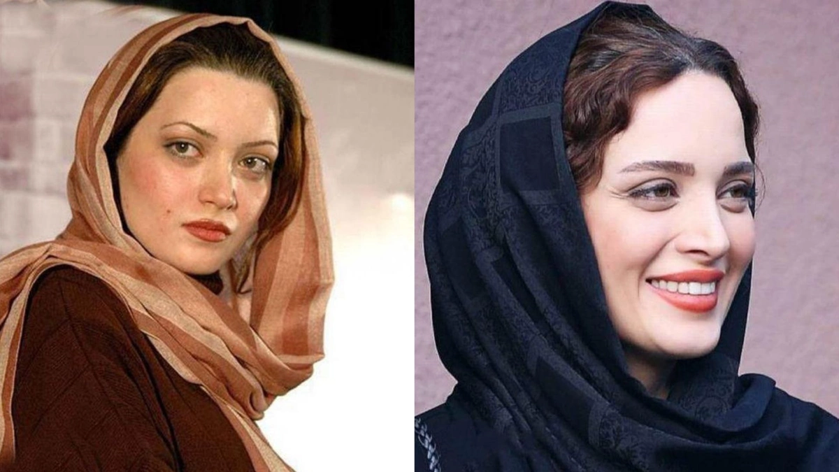 قبل و بعد افراد مشهور ایرانی 6 قبل و بعد افراد مشهور ایرانی 6