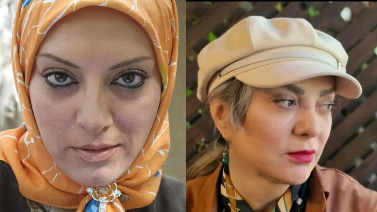 مقایسه چهره حمیرا ریاضی در گذشته و امروز