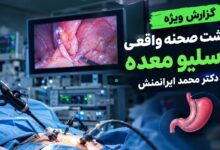 گزارش ویژه از پشت صحنه واقعی اسلیو معده با دکتر محمد ایرانمنش