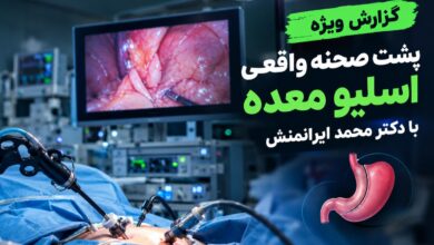 گزارش ویژه از پشت صحنه واقعی اسلیو معده با دکتر محمد ایرانمنش