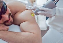 لیزر شاتی بهتره یا رولی؟ مقایسه مزایا، معایب و تفاوت‌های دستگاه لیزر رولی با شاتی