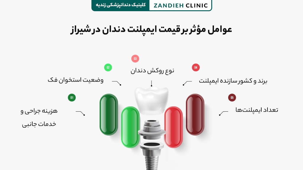 ایمپلنت اقساطی در شیراز؛ مراحل درمان و برنامه-ریزی هزینه-ها - تصویر 1 هزینه ایمپلنت اقساطی در شیراز چگونه محاسبه می شود؟
